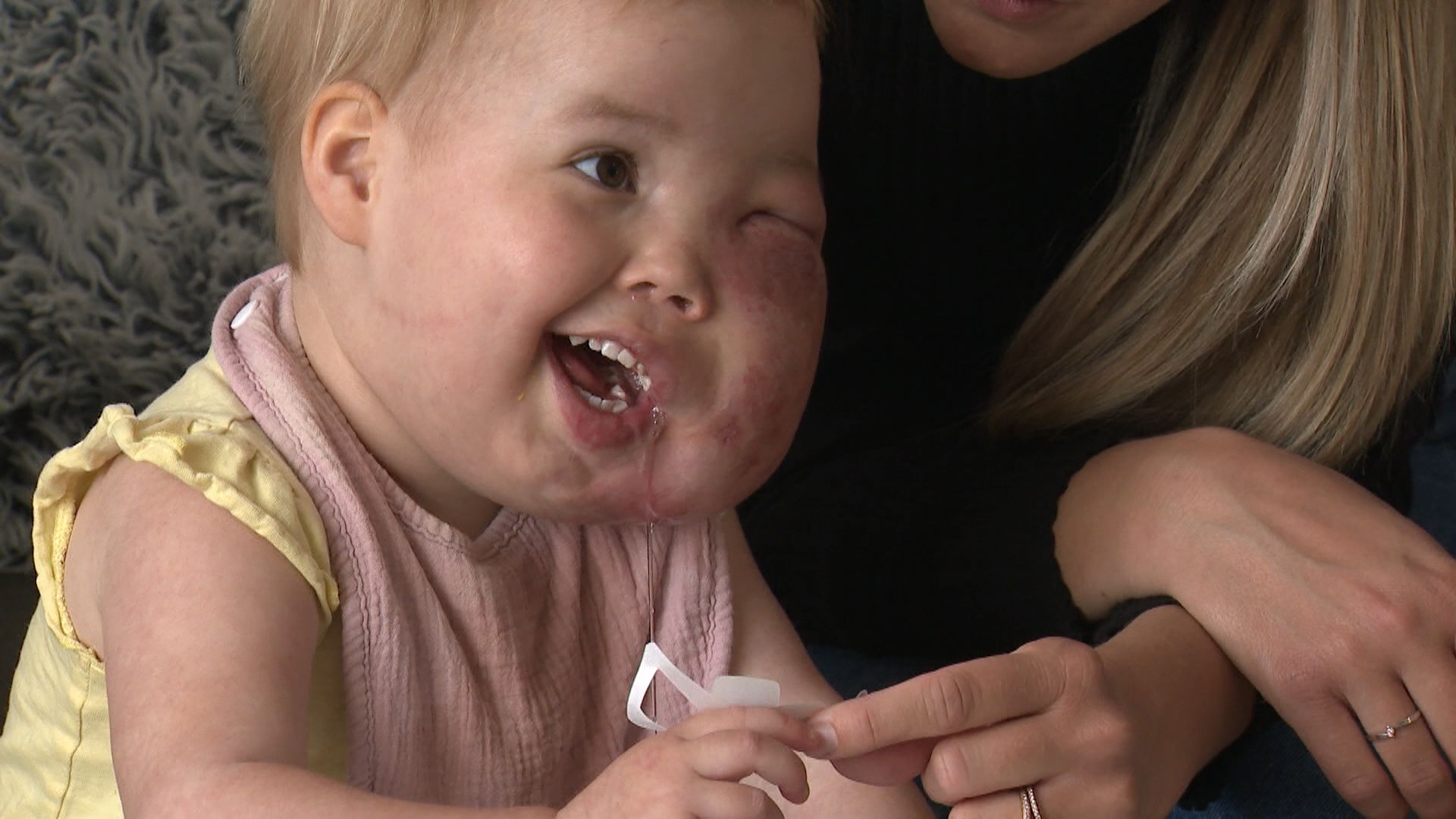Alberta Family Faces ‘uncertain Future’ After Toddler’s Rare Disease Care Funding Denied - Beritaja