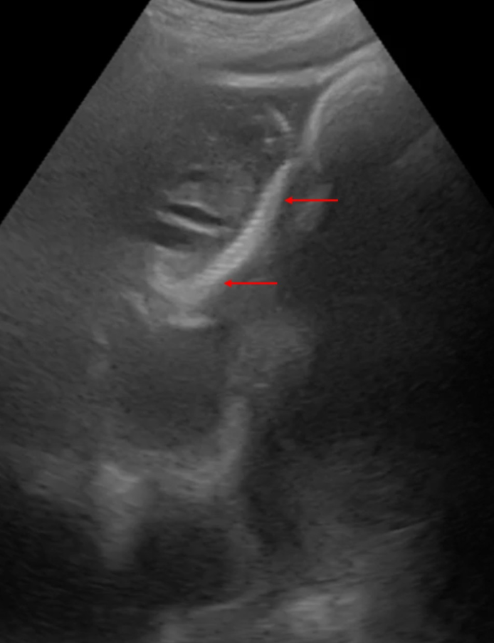 This endangered pygmy hippo is expecting baby number two this summer.