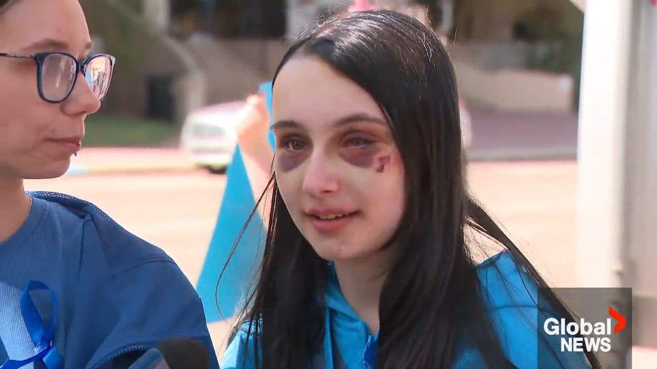 Hundreds Rally In Red Deer To Support Teenage Girl Recovering From Violent Assault - Beritaja