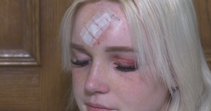 Okotoks Family Speaks Out After Driver Hits A Teen Pedestrian From Behind - Beritaja