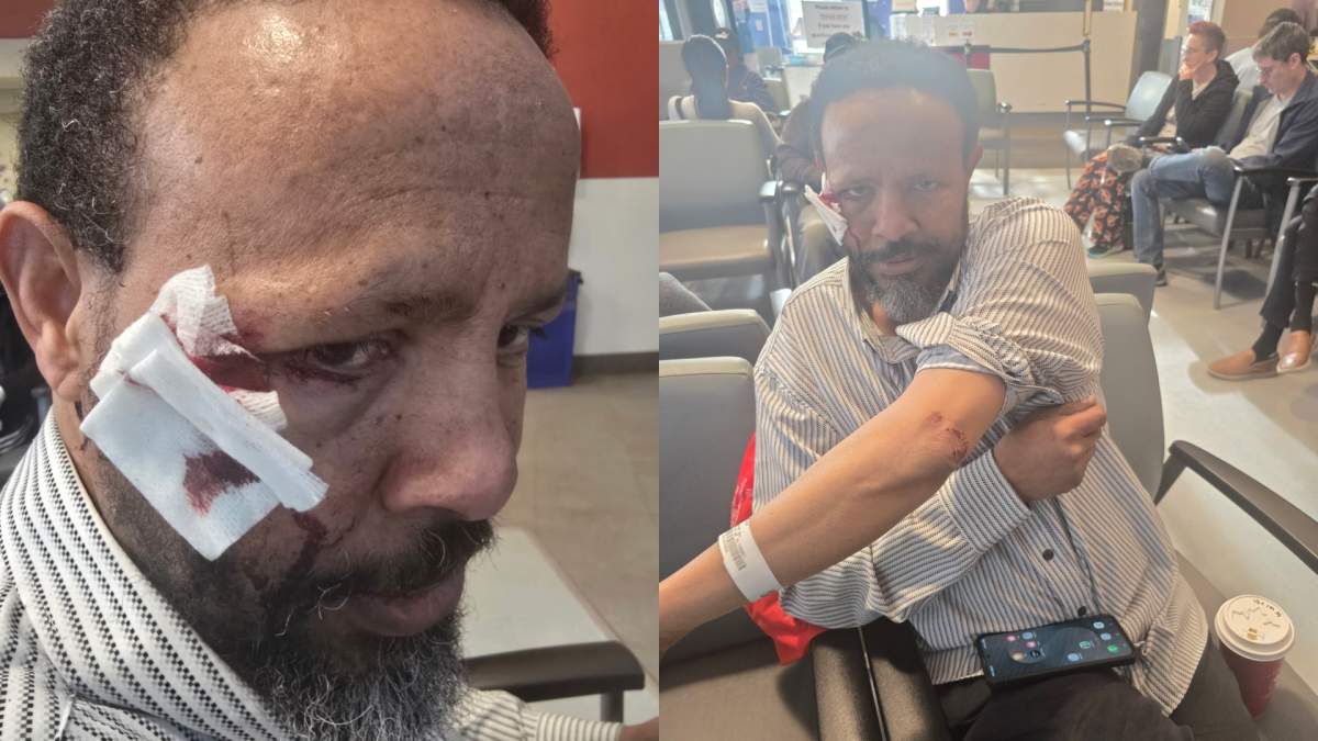 Muslim Association of St. Albert member Ali Wahad Noor at the hospital after being assaulted after Friday prayers on May 1, 2026.