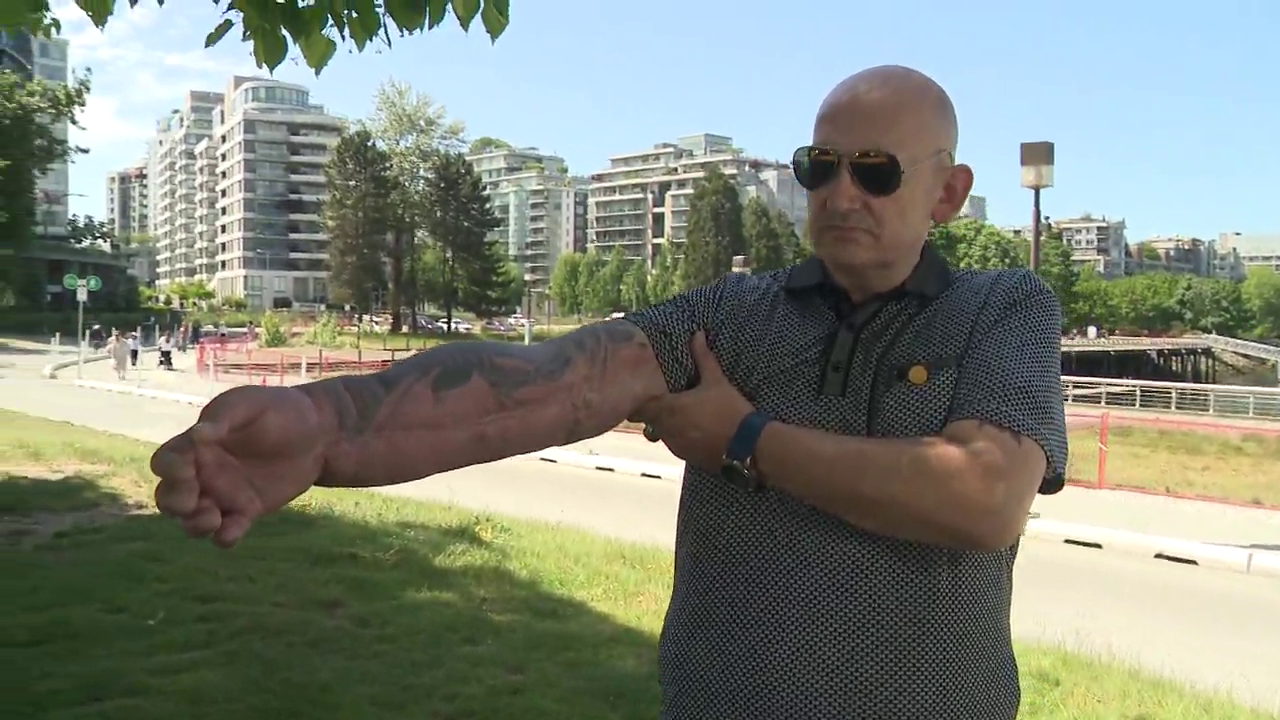Why Canada Vaccine Injury Support Program is Leaving People in Financial Ruin