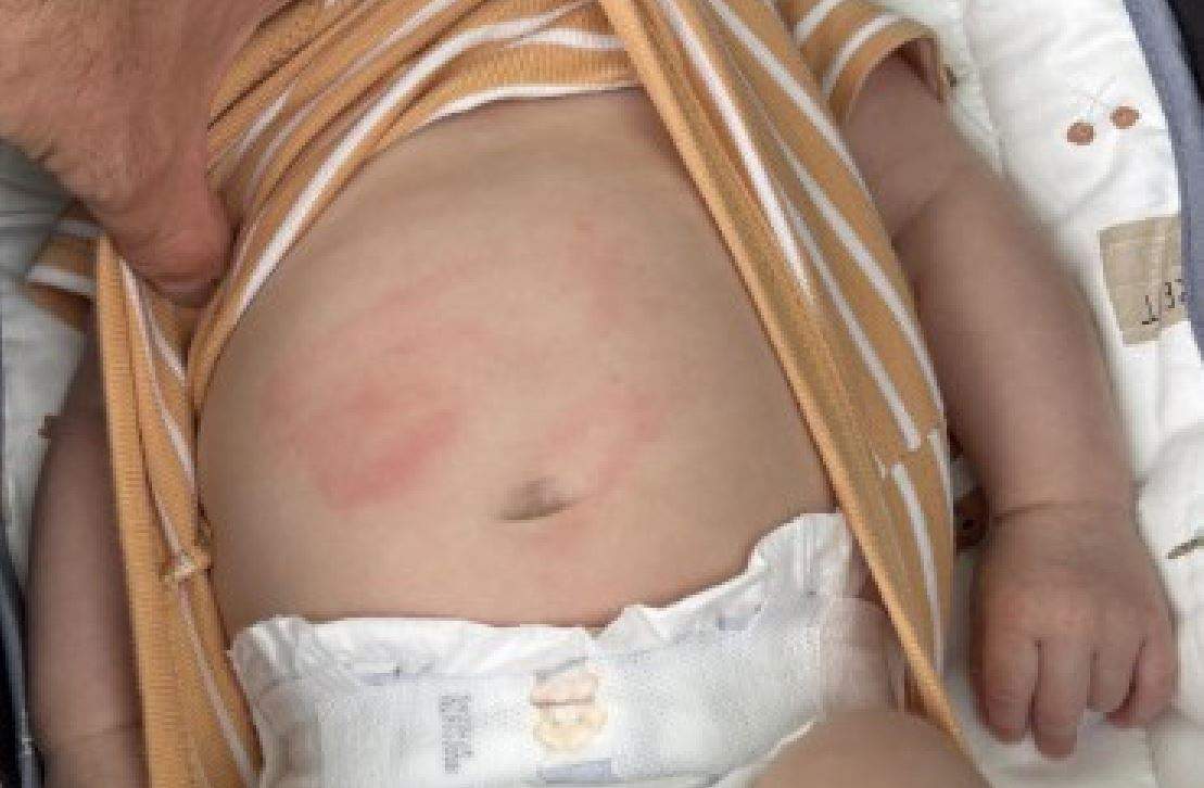 Boy who allegedly assaulted 9-week-old baby wanted by Calgary police