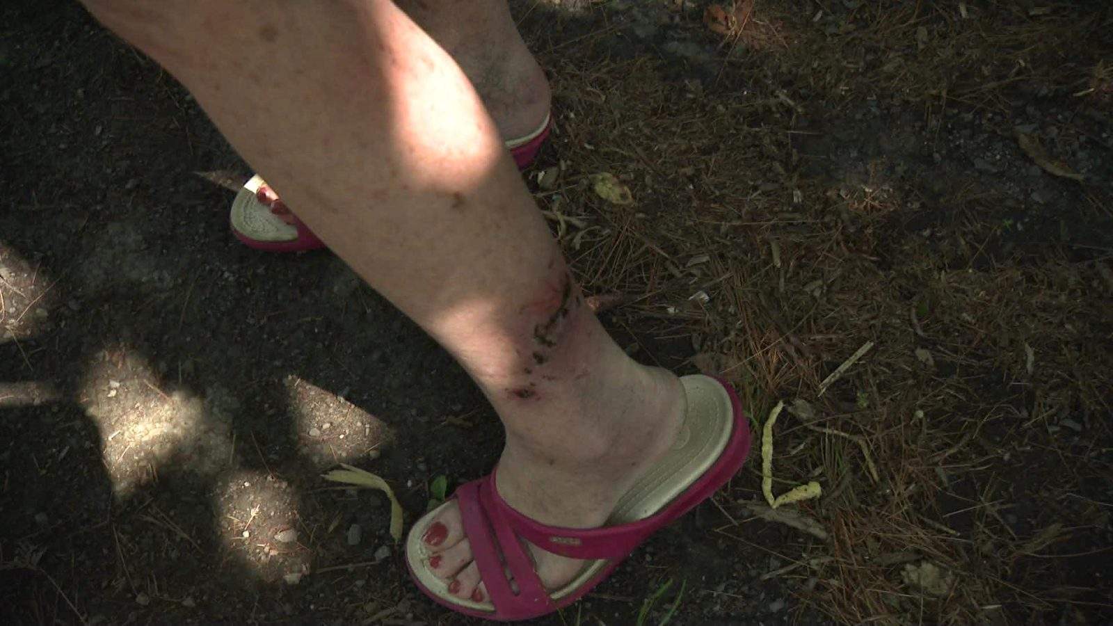 Quebec health officials confirm 2nd Montreal cat with raccoon rabies