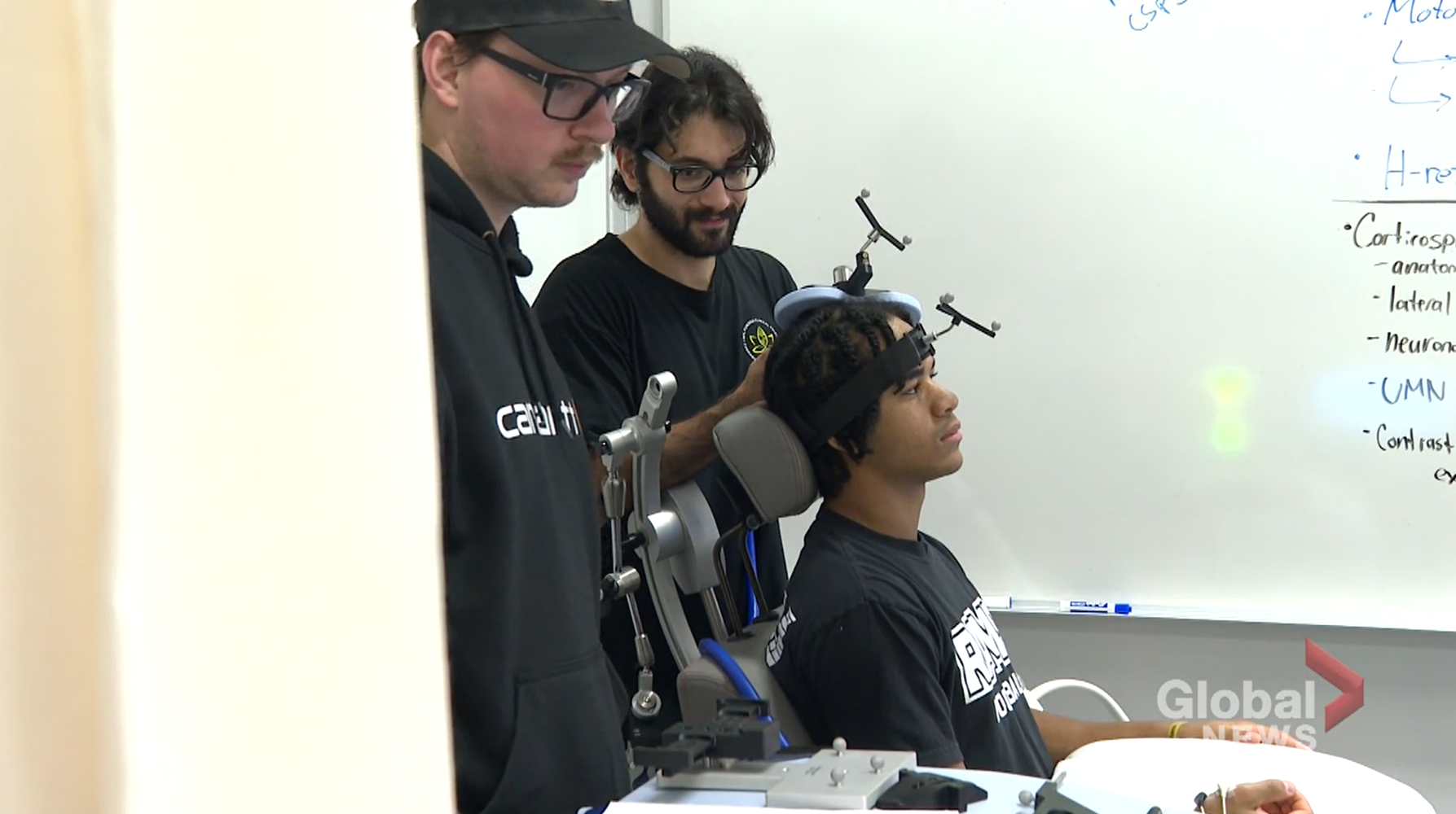 Why Researchers Are Betting On Cbd For Concussion Recovery