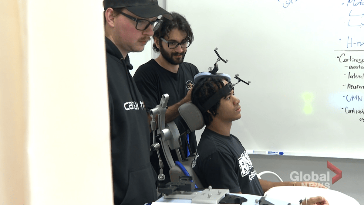 University of Regina studies new concussion treatment option: CBD